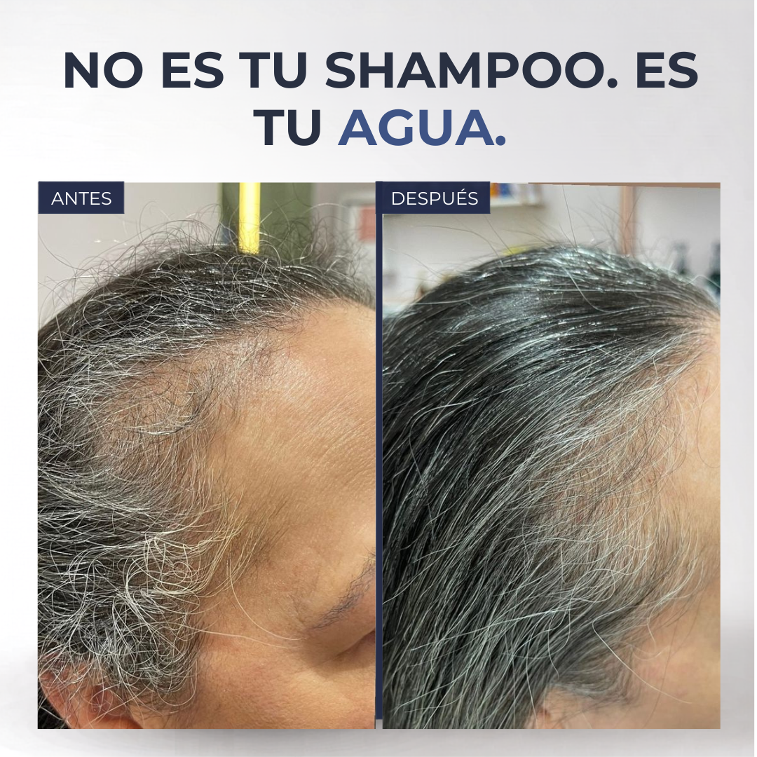 ReviFlux - Piel Sana con Agua Pura