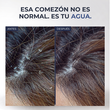 ReviFlux - Piel Sana con Agua Pura